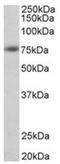 Amyloid Beta Precursor Protein antibody, AP31949PU-N, Origene, Western Blot image 
