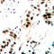 Jun Proto-Oncogene, AP-1 Transcription Factor Subunit antibody, LS-C368400, Lifespan Biosciences, Immunohistochemistry paraffin image 