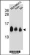 NADH:Ubiquinone Oxidoreductase Subunit C2 antibody, 55-384, ProSci, Western Blot image 