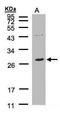 Linker for activation of T-cells family member 2 antibody, GTX106463, GeneTex, Western Blot image 