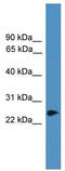 RING finger protein 114 antibody, TA345260, Origene, Western Blot image 