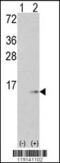 S100 Calcium Binding Protein A6 antibody, 62-845, ProSci, Western Blot image 