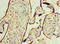 WT1 Transcription Factor antibody, A56679-100, Epigentek, Immunohistochemistry paraffin image 