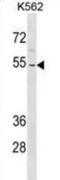 Zinc Finger Protein 736 antibody, abx030855, Abbexa, Western Blot image 