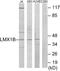 LIM Homeobox Transcription Factor 1 Beta antibody, EKC1641, Boster Biological Technology, Western Blot image 