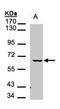 Serine/threonine-protein kinase MAK antibody, NBP1-32344, Novus Biologicals, Western Blot image 