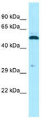 Sperm Adhesion Molecule 1 antibody, TA337855, Origene, Western Blot image 