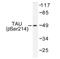 PHF-tau antibody, AP01703PU-N, Origene, Western Blot image 