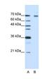 Fatty Acid Binding Protein 2 antibody, orb77222, Biorbyt, Western Blot image 