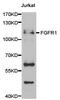 Fibroblast Growth Factor Receptor 1 antibody, TA327256, Origene, Western Blot image 