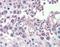 CPX Chromosome Region Candidate 1 antibody, NBP1-80386, Novus Biologicals, Immunohistochemistry paraffin image 
