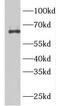 Rho guanine nucleotide exchange factor 25 antibody, FNab03414, FineTest, Western Blot image 
