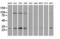 Nicotinamide N-Methyltransferase antibody, LS-C172704, Lifespan Biosciences, Western Blot image 
