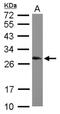 Small Nuclear Ribonucleoprotein Polypeptides B And B1 antibody, NBP1-32174, Novus Biologicals, Western Blot image 