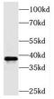 Peroxisomal Biogenesis Factor 16 antibody, FNab06328, FineTest, Western Blot image 