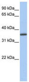 UDP-Galactose-4-Epimerase antibody, TA334924, Origene, Western Blot image 