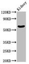 Mannosyl (Beta-1,4-)-Glycoprotein Beta-1,4-N-Acetylglucosaminyltransferase antibody, CSB-PA22969A0Rb, Cusabio, Western Blot image 