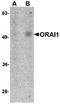 ORAI Calcium Release-Activated Calcium Modulator 1 antibody, LS-C144492, Lifespan Biosciences, Western Blot image 