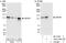 ESF1 Nucleolar Pre-RRNA Processing Protein Homolog antibody, A303-165A, Bethyl Labs, Immunoprecipitation image 