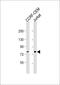 NADH-ubiquinone oxidoreductase chain 5 antibody, 62-551, ProSci, Western Blot image 