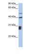 LOC652825 antibody, orb325470, Biorbyt, Western Blot image 