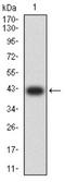Branched Chain Amino Acid Transaminase 2 antibody, NBP2-61699, Novus Biologicals, Western Blot image 