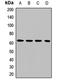 Inactive ubiquitin-specific peptidase 39 antibody, LS-C668533, Lifespan Biosciences, Western Blot image 