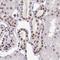 Paired amphipathic helix protein Sin3a antibody, NBP2-38949, Novus Biologicals, Immunohistochemistry paraffin image 