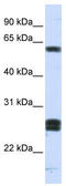 Hyaluronan-binding protein 2 antibody, TA335072, Origene, Western Blot image 