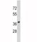 SPARC antibody, F49838-0.4ML, NSJ Bioreagents, Western Blot image 
