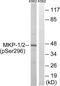 Dual specificity protein phosphatase 1 antibody, LS-C199264, Lifespan Biosciences, Western Blot image 