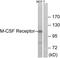 FMS antibody, TA312193, Origene, Western Blot image 