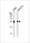 Mesoderm Development LRP Chaperone antibody, 55-956, ProSci, Western Blot image 