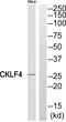 CKLF Like MARVEL Transmembrane Domain Containing 4 antibody, PA5-39107, Invitrogen Antibodies, Western Blot image 