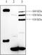 Low Density Lipoprotein Receptor antibody, ab30532, Abcam, Western Blot image 