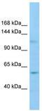Glutamate Receptor Interacting Protein 2 antibody, TA338324, Origene, Western Blot image 