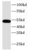 K17 antibody, FNab02201, FineTest, Western Blot image 