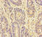 Cyclin Dependent Kinase 11A antibody, A54009-100, Epigentek, Immunohistochemistry paraffin image 