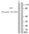 Valosin Containing Protein antibody, TA312335, Origene, Western Blot image 