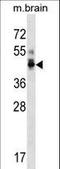 Protein Phosphatase 1 Regulatory Subunit 7 antibody, LS-C158715, Lifespan Biosciences, Western Blot image 