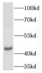 Tachykinin Receptor 2 antibody, FNab08471, FineTest, Western Blot image 