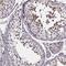 Sperm Associated Antigen 8 antibody, NBP2-39092, Novus Biologicals, Immunohistochemistry paraffin image 