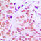 Jun Proto-Oncogene, AP-1 Transcription Factor Subunit antibody, LS-C352427, Lifespan Biosciences, Immunohistochemistry frozen image 
