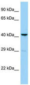 Serine Protease 35 antibody, TA337739, Origene, Western Blot image 