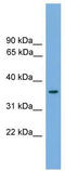 Forkhead Box F1 antibody, TA342260, Origene, Western Blot image 