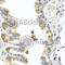 Chitinase 3 Like 2 antibody, A7654, ABclonal Technology, Immunohistochemistry paraffin image 