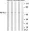 RAB11 Family Interacting Protein 2 antibody, GTX87690, GeneTex, Western Blot image 