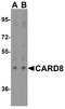 Caspase Recruitment Domain Family Member 8 antibody, A03404-1, Boster Biological Technology, Western Blot image 