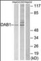 Disabled homolog 1 antibody, orb137647, Biorbyt, Western Blot image 