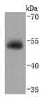 GC Vitamin D Binding Protein antibody, NBP2-66786, Novus Biologicals, Western Blot image 